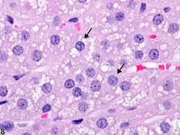 Attēlu rezultāti vaicājumam “Perichaena corticalis sessile”