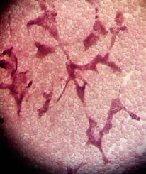 Attēlu rezultāti vaicājumam “Cribraria oregana”