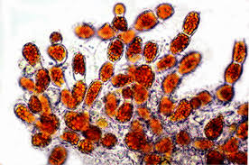 Attēlu rezultāti vaicājumam “Trentepohlia sp.”