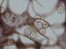 Attēlu rezultāti vaicājumam “Cribraria oregana spores”