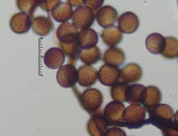 Attēlu rezultāti vaicājumam “Amaurochaete atra spores”