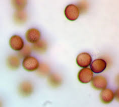 Attēlu rezultāti vaicājumam “Amaurochaete sp.”