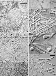 Attēlu rezultāti vaicājumam “Hypocrea pulvinata”