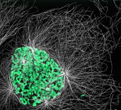 Attēlu rezultāti vaicājumam “Didymium clavus spores”