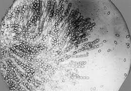 Attēlu rezultāti vaicājumam “Didymium annulisporum spores”