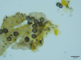 Attēlu rezultāti vaicājumam “Licea testudinacea young”