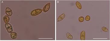 Attēlu rezultāti vaicājumam “Anastrophyllum minutum”