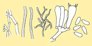 Attēlu rezultāti vaicājumam “Trametes gibbosa”