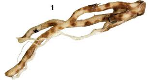 Attēlu rezultāti vaicājumam “Athelia pyriformis”