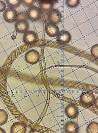 Attēlu rezultāti vaicājumam “Trichiaceae, Hemitrichiaceae, Arcyriaceae”