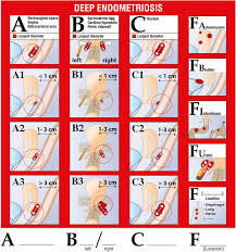 Image result for Enzian