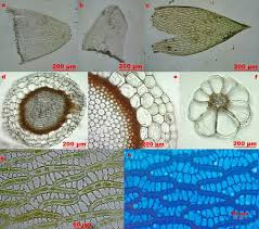 Attēlu rezultāti vaicājumam “Seligeria campylopoda sporophyte”
