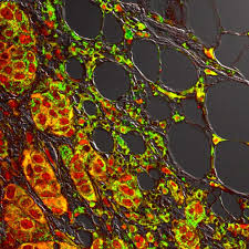 Attēlu rezultāti vaicājumam “Phragmidium sp.”