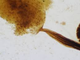 Attēlu rezultāti vaicājumam “Physarum bryocorticola spores”