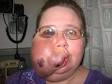Melissa's Story. Melissa My name is Melissa A. Freeman. I am 36 yrs. - melissa1