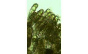 Attēlu rezultāti vaicājumam “Saelania glaucescens sporophyte”