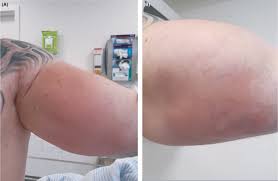 Image result for SYNTHOL