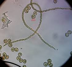 Attēlu rezultāti vaicājumam “Ophiotheca sp.”