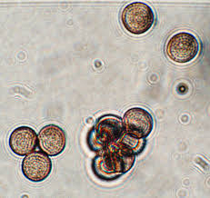 Attēlu rezultāti vaicājumam “Willkommlangea reticulata”