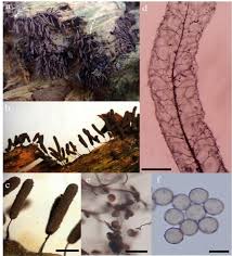 Attēlu rezultāti vaicājumam “Stemonitis flavogenita spores”