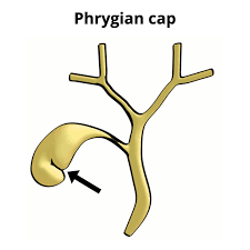 Image result for Phrygian cap