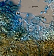 Attēlu rezultāti vaicājumam “Fuligo leviderma spores”