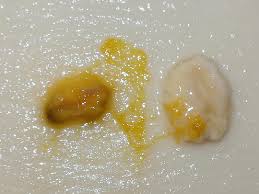 Attēlu rezultāti vaicājumam “Badhamia capsulifera”