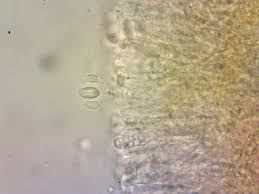 Attēlu rezultāti vaicājumam “Didymium clavus spores”