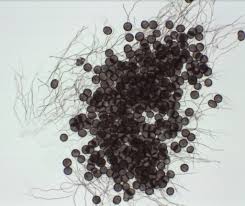 Attēlu rezultāti vaicājumam “Diderma umbilicatum stalked”