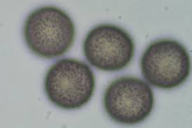 Attēlu rezultāti vaicājumam “Didymium bahiense spores”