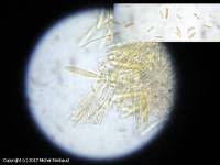 Attēlu rezultāti vaicājumam “Hyaloscypha hyalina”