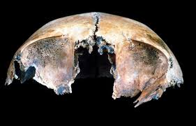 Attēlu rezultāti vaicājumam “Cribraria piriformis stalked”