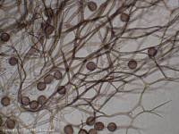 Attēlu rezultāti vaicājumam “Colloderma oculatum spores”