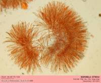 Attēlu rezultāti vaicājumam “Bisporella citrina”