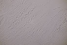 Attēlu rezultāti vaicājumam “Ruzenia spermoides”