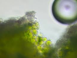 Attēlu rezultāti vaicājumam “Chaenotheca chlorella”