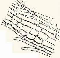 Attēlu rezultāti vaicājumam “Lachnellula willkommii”