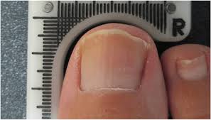 Image result for lunula nail