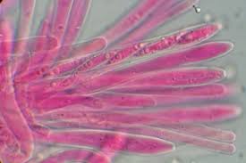 Attēlu rezultāti vaicājumam “Heyderia pusilla”