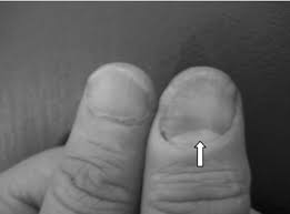 Image result for lunula nail