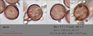 Attēlu rezultāti vaicājumam “Fuligo gyrosa spores”