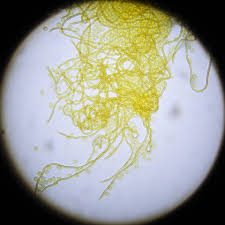 Attēlu rezultāti vaicājumam “Oligonema affine”