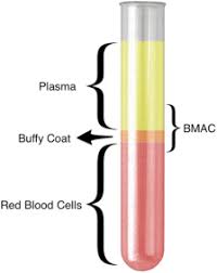 Image result for BMAC