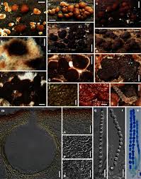 Attēlu rezultāti vaicājumam “Melanospora lagenaria”