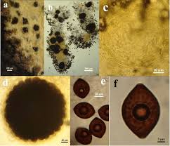 Attēlu rezultāti vaicājumam “Melanospora lagenaria”