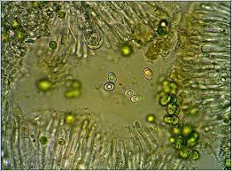 Attēlu rezultāti vaicājumam “Melanohalea exasperata”
