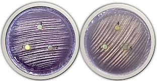 Attēlu rezultāti vaicājumam “Dicranella staphylina cells”