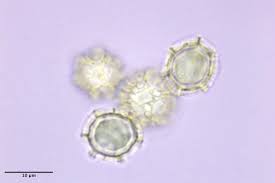 Attēlu rezultāti vaicājumam “Oligonema persimile spores”