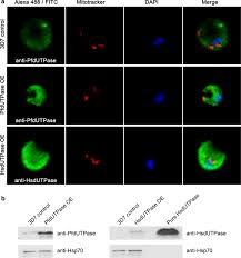 Attēlu rezultāti vaicājumam “Diachea muscorum plasmodium”