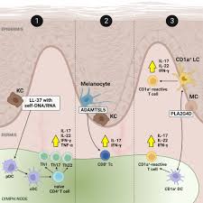 Image result for Withins Tc